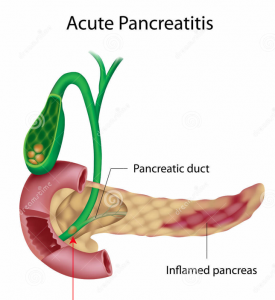 Pancreatitis. German New Medicine Education.