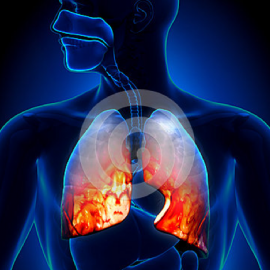 Bronchitis & Pneumonia Bronchitis & Pneumonia