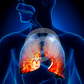 Bronchitis & Pneumonia