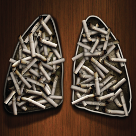 Lung Cancer Programs Lung Cancer Programs