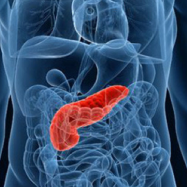 Pancreatic Cancer Pancreatic Cancer