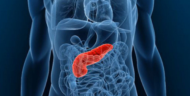 Pancreatic Cancer