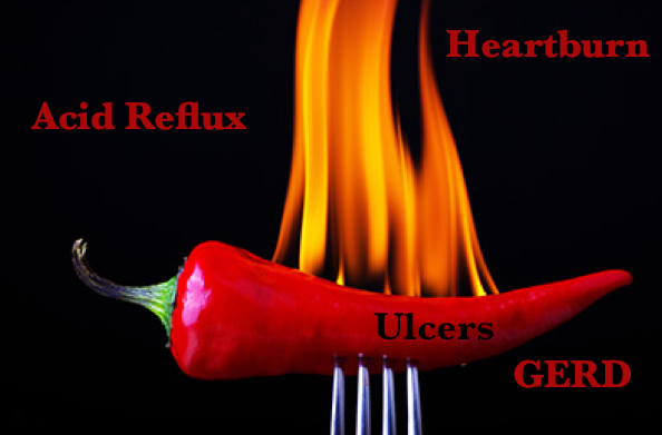 Heartburn. (GERD) Gastroesophageal Reflux Disease. Ulcers