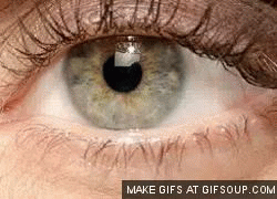 Essential Blepharospasm Essential Blepharospasm
