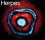 herpes10