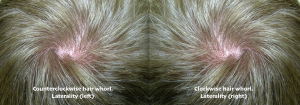 way the whorl turns